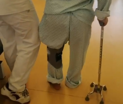 【案例996】多维康复治疗下,用时82天,患者从“步履蹒跚、表达困难”到“步态稳